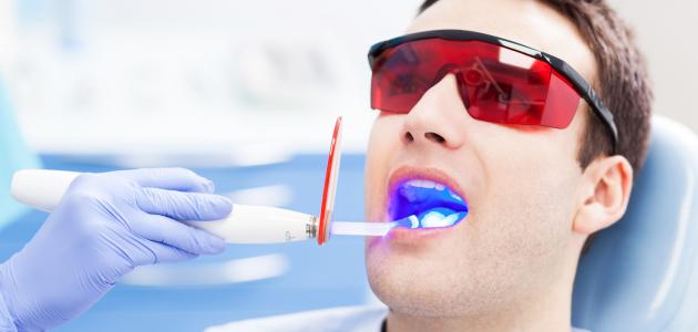 احدث تقنيات تبييض الاسنان